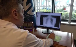 Kadınlarda akciğer kanseri vakalarında artış yaşanıyor