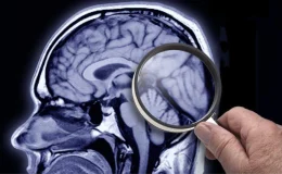 İngiltere Alzheimer hastalığını erken teşhis etmek için kan testleri yapıyor