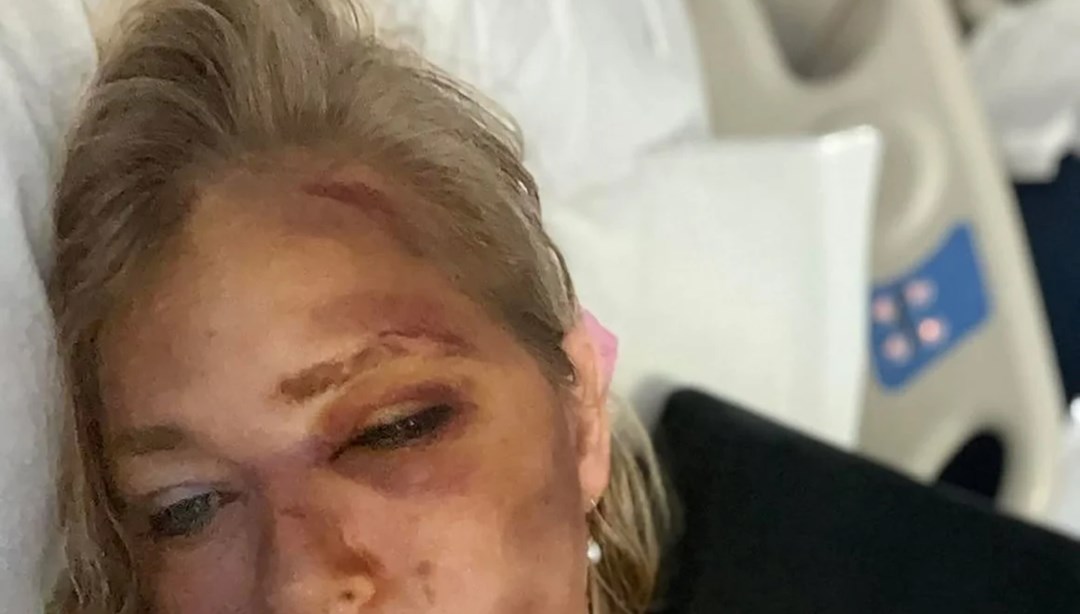 Pedofili milyarder Epstein kurbanı kadın kaza geçirdi!  “Sayılı günüm kaldı”